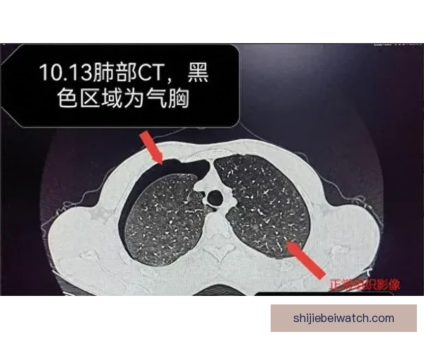 坎宁安气胸恢复顺利 活塞官方公布复查时间和复出计划