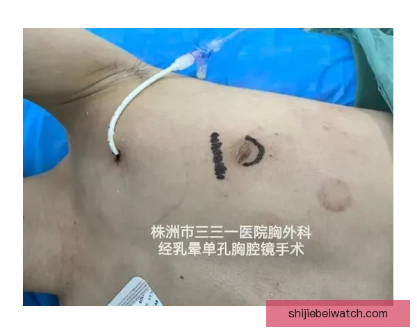 坎宁安气胸康复持续推进 活塞计划一周后复查评估